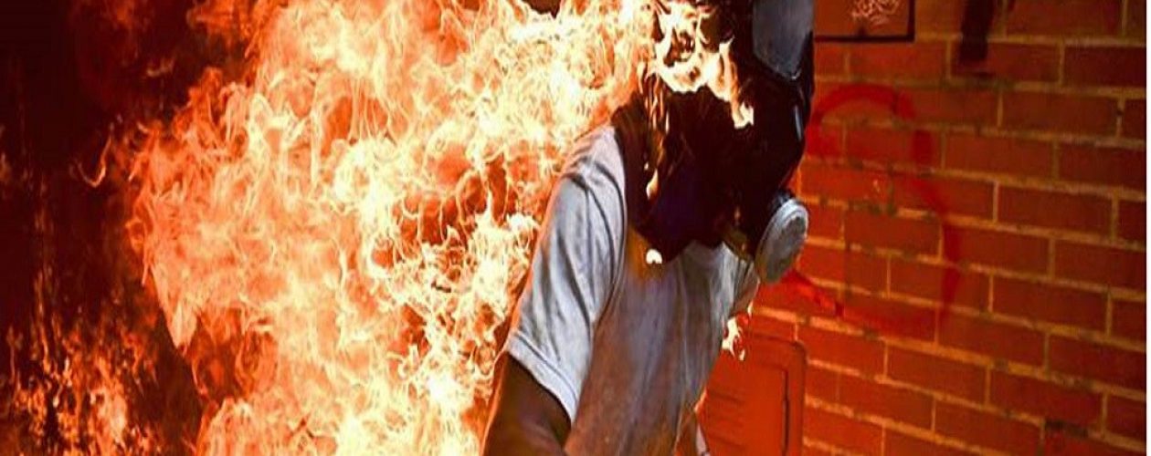 Ronaldo Schemidt ganó mejor fotografía periodística con imagen de manifestante en llamas