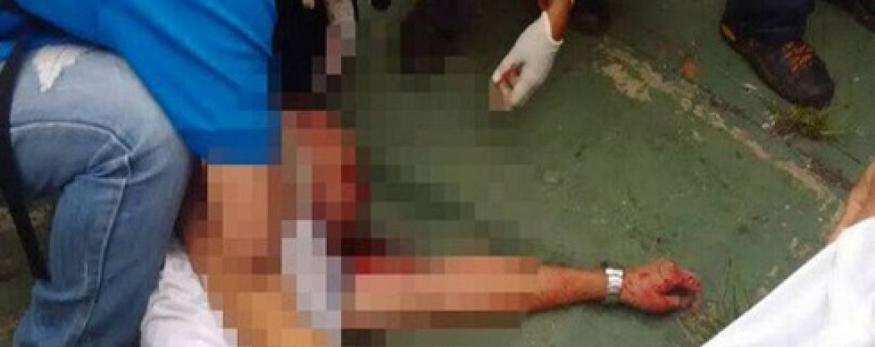 Anderson Dugarte falleció tras resultar herido durante protesta en Mérida
