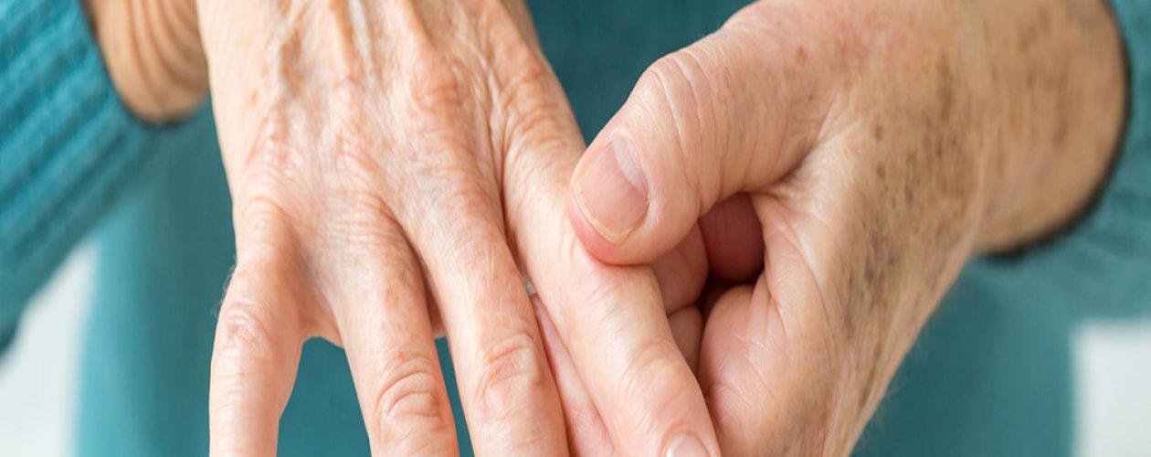 Artritis reumatoide: una enfermedad más común de lo que se cree