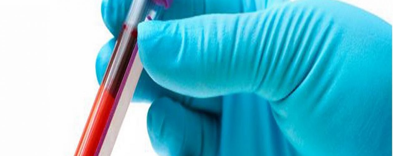 Nueva prueba de sangre permitiría detectar el cáncer en primera etapa