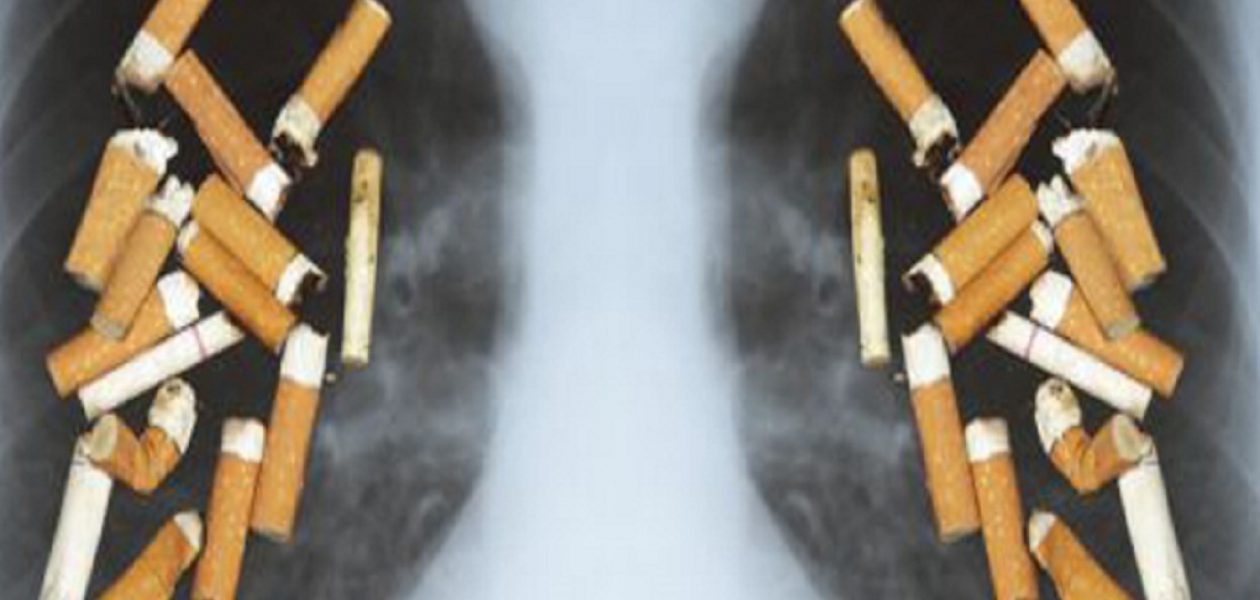 Día Mundial sin Tabaco: 1,69 millones de personas mueren por cáncer pulmonar