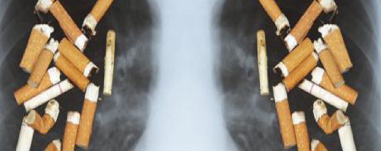 Día Mundial sin Tabaco: 1,69 millones de personas mueren por cáncer pulmonar