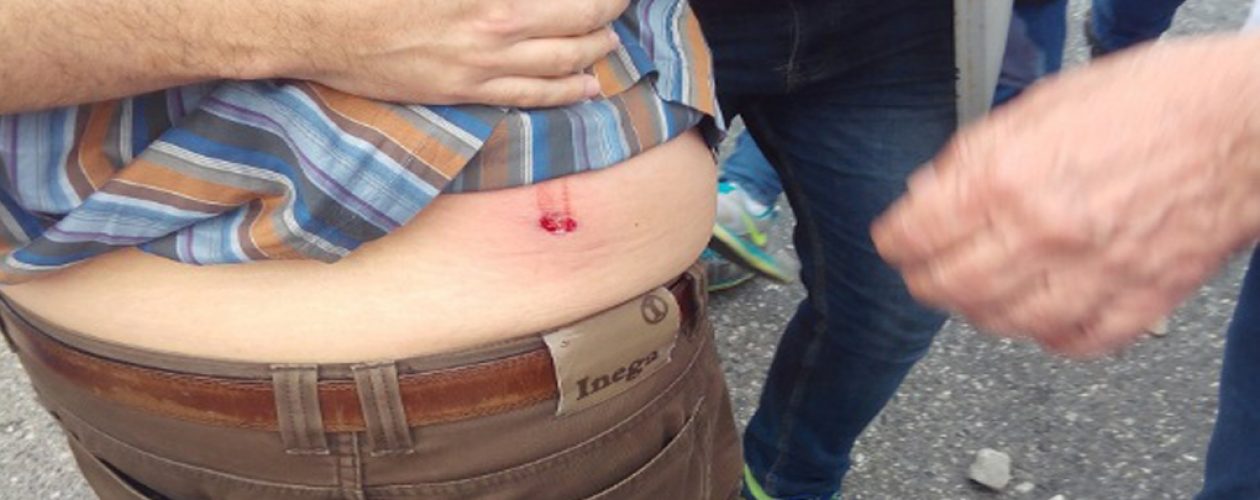 Diputado Guillermo Palacios resultó herido durante protesta en Lara