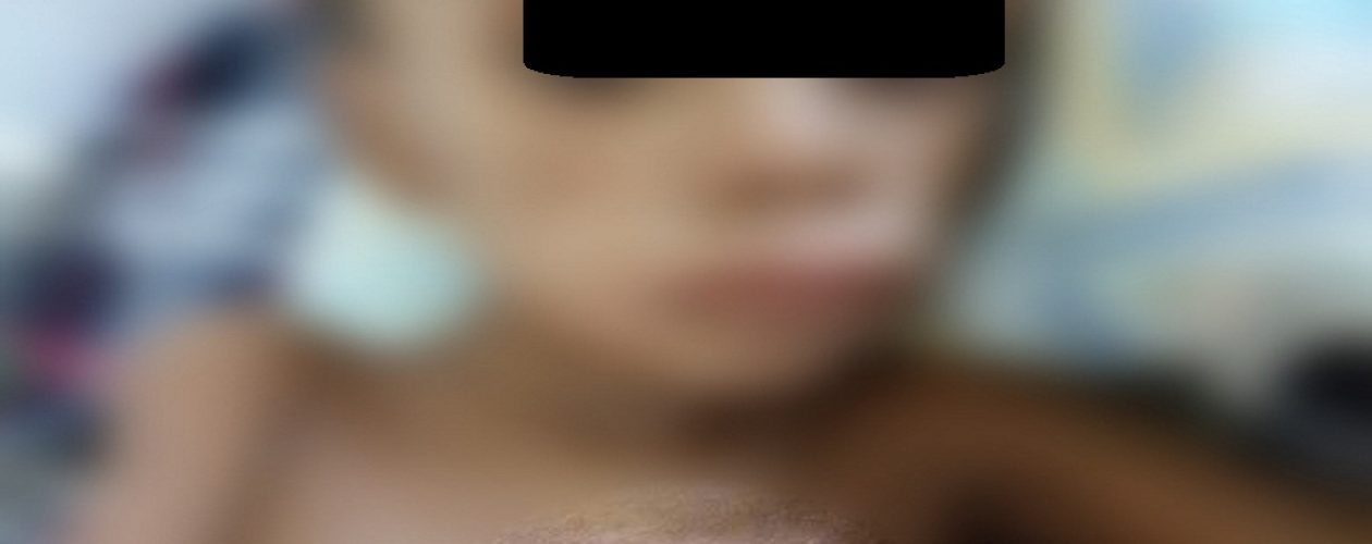 Fallece otro niño con desnutrición en Bolívar