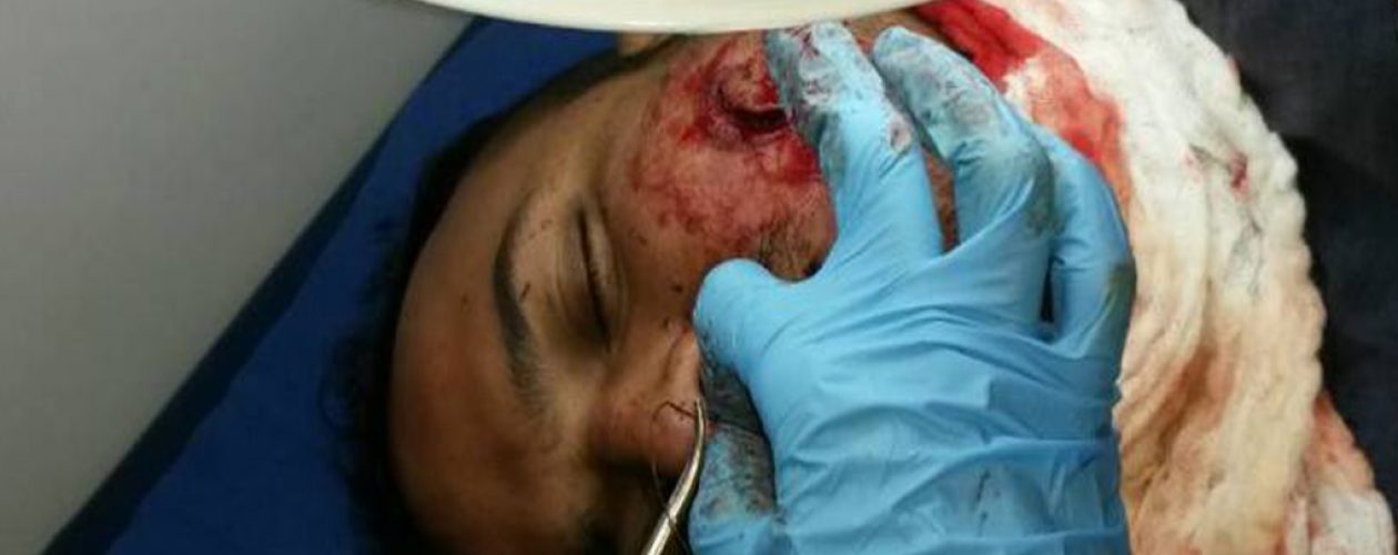 Más 50 de heridos durante Paro Cívico en Táchira