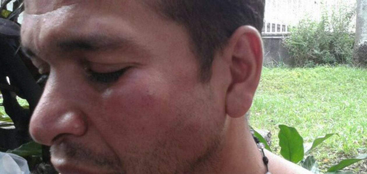 Guardia Nacional detuvo y agredió a periodista de la MUD