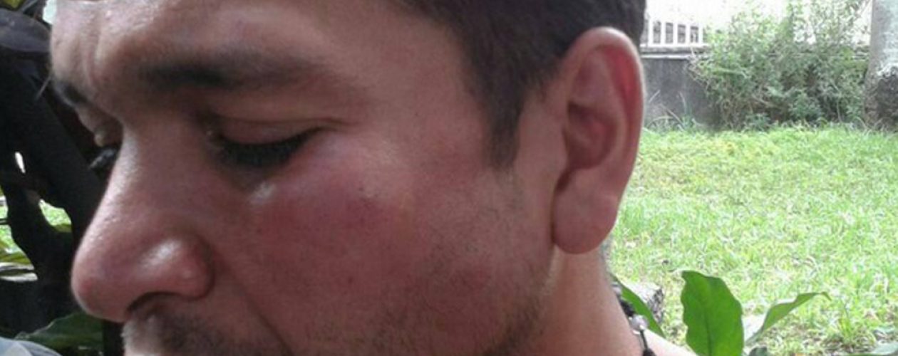Guardia Nacional detuvo y agredió a periodista de la MUD