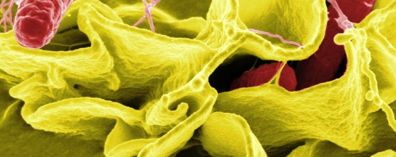 “Salmonella puede matar a cualquiera por falta de antibióticos”