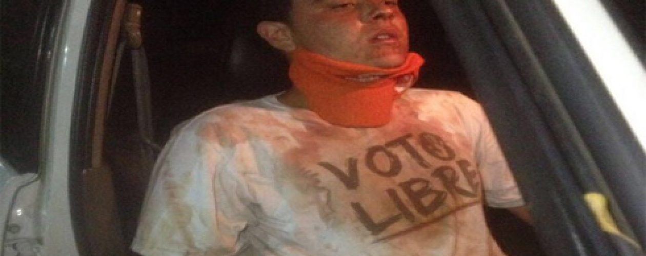 Sebin agredió a un militante de Voluntad Popular del Zulia